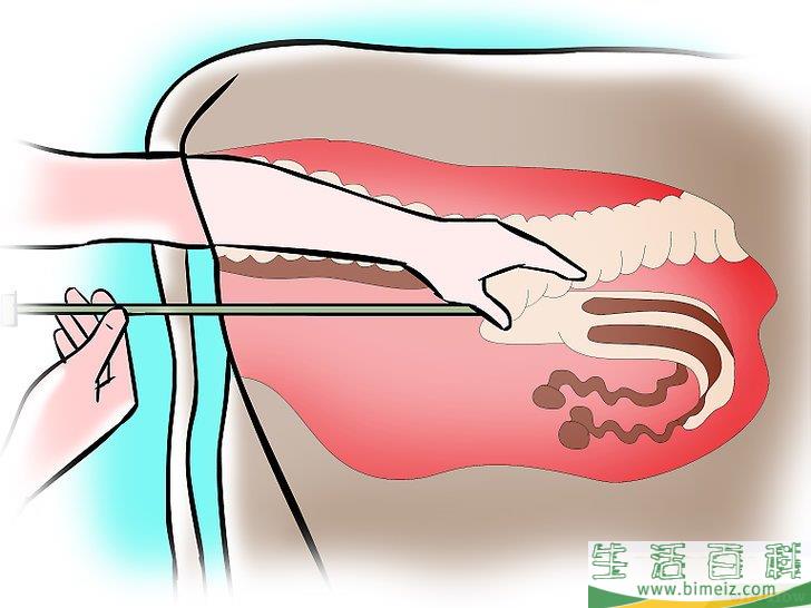 方法3为母牛进行人工授精