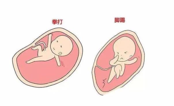 胎动位置图图片