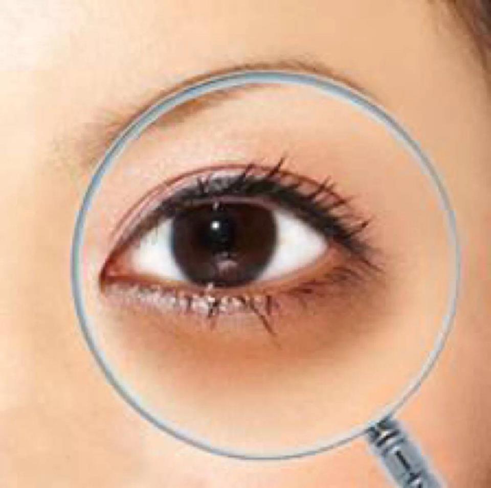 有黑眼圈怎么消除(如何拯救黑眼圈?